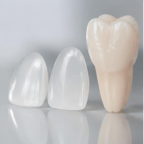 Lentes de Contato Dental
